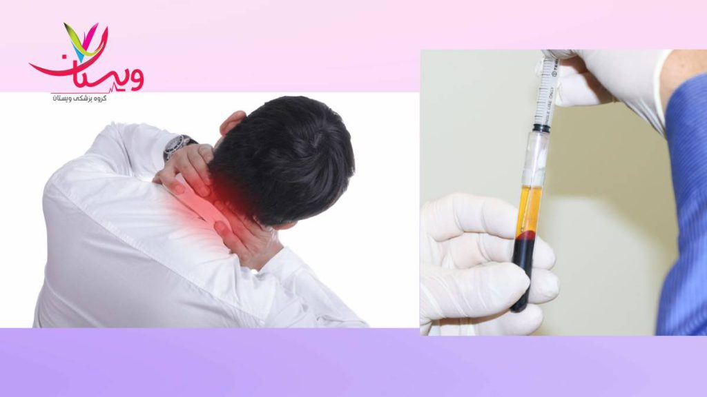 شرایط تزریق افراد دارای شرایط پی ار پی دیسک گردن