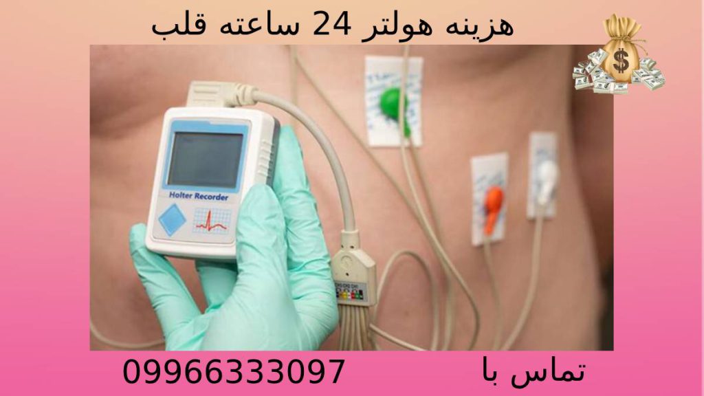 هزینه هولتر 24 ساعته قلب