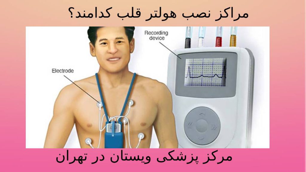 نصب هولتر در ویستان معرفی مرکزهای نصب هولتر قلب