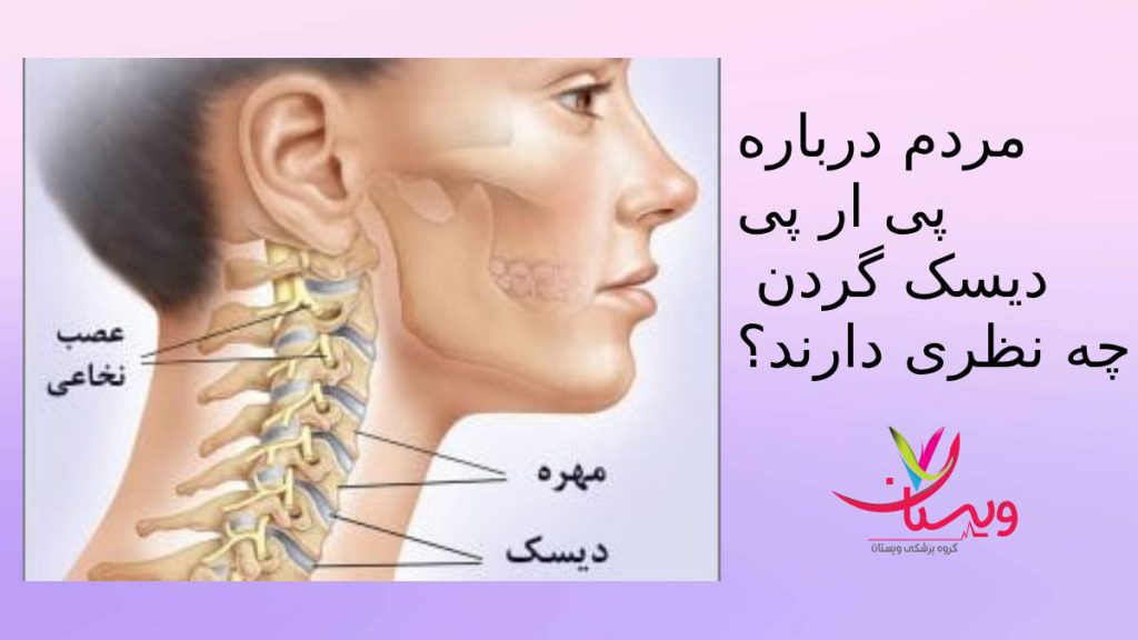 نظرات مردم در مورد prp گردن نظرات تزریق کنندگان پی ار پی گردن