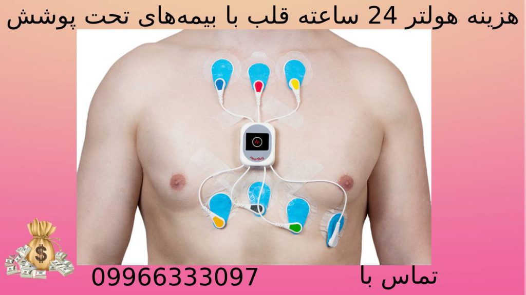 قیمت هولتر 24 ساعته با بیمه قیمت هولتر قلب با بیمههای تحت پوشش