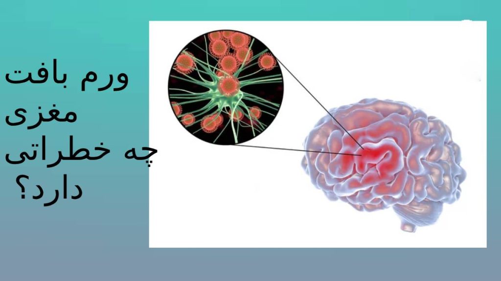 خطرتاکی آسیب بافت مغزی میزان خطرات ناشی از التهاب بر روی مغز