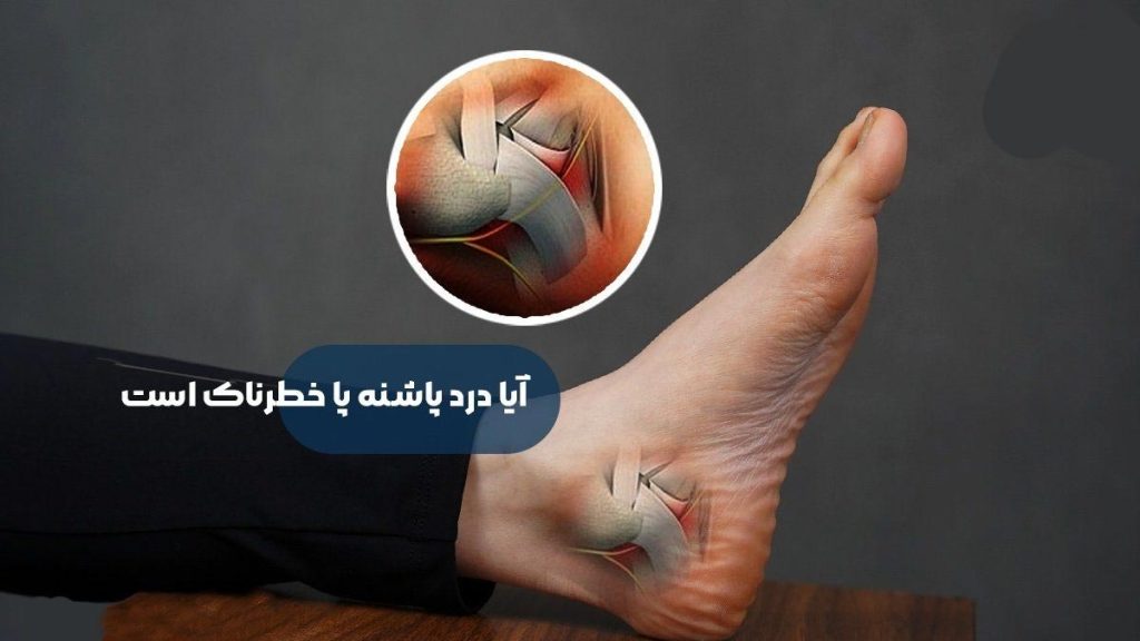 درد پاشنه پاها و خطرناک بودن آن خطرناک بودن درد پاشنه پا
