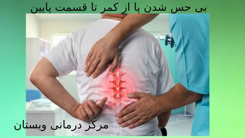 دلایل بی حسی پا از کمر علتهای حس نداشتن پا از قسمت کمر تا ناحیه پایین بدن