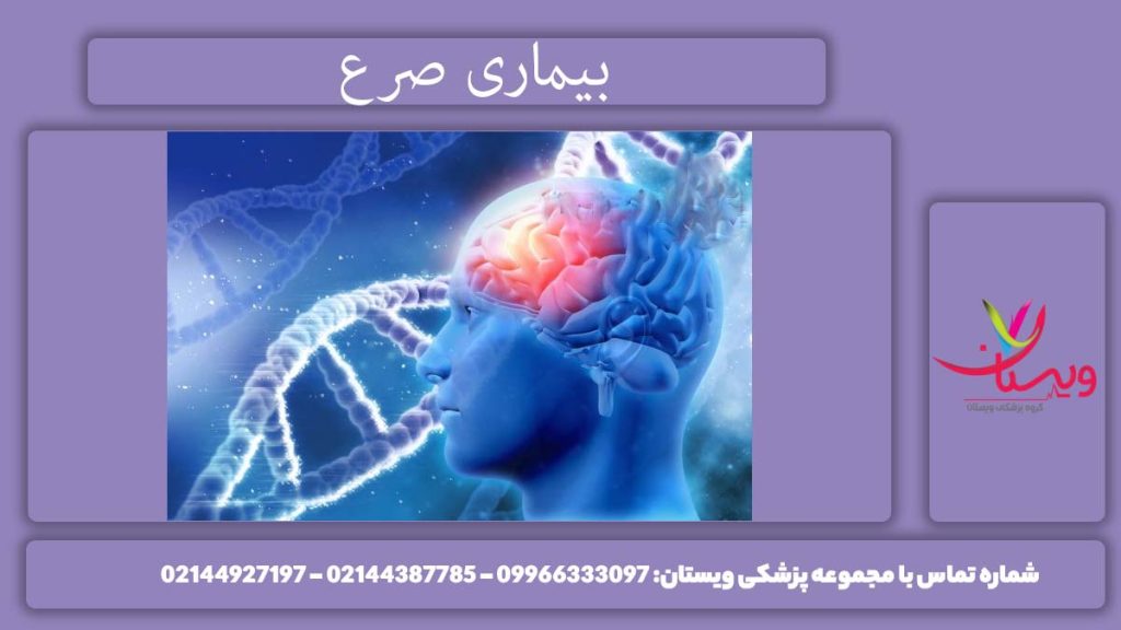 معرفی بیماری صرع