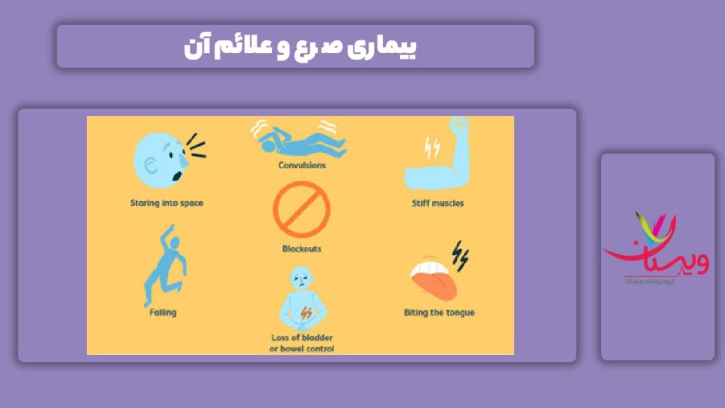نشانه این بیماری صرع