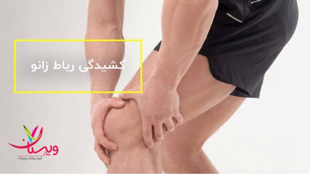 حالت کش امدن رباط کشیده شدن رباط ناحیه زانو