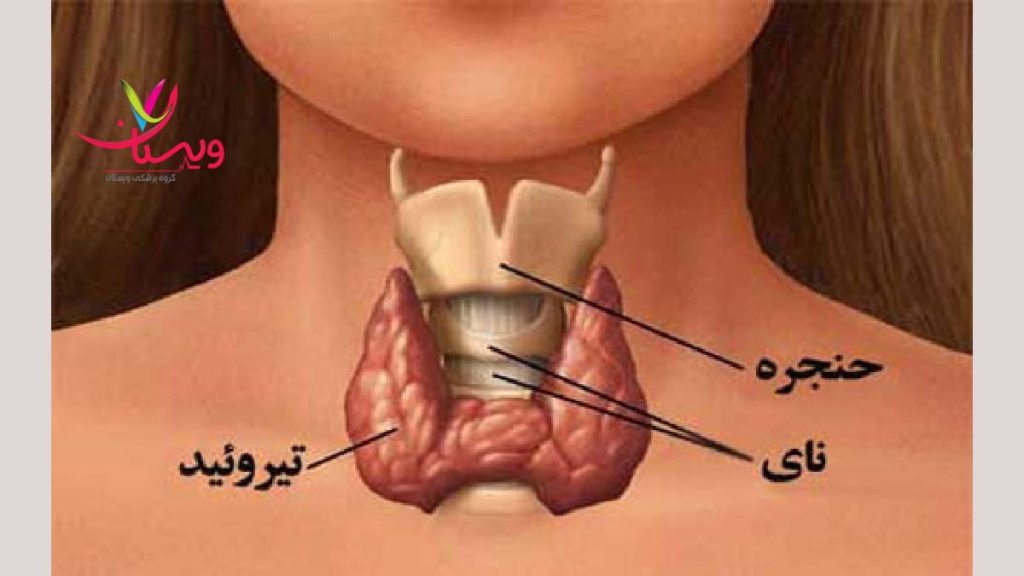 تیروئید و ربط آن به مشکل بلع تیروئید و مشکلهای بلع