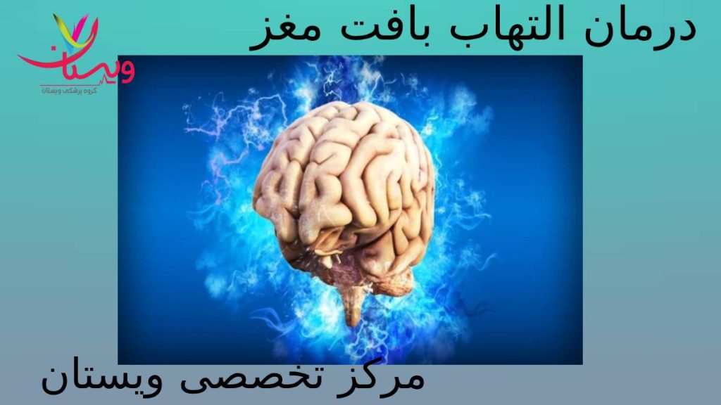 درمان آنسفالیت در ویستان درمان التهاب بافت مغز در گروه ویستان