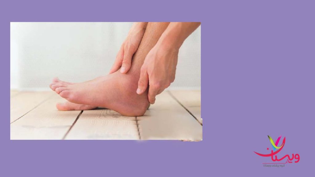 درمان خانگی تاندون پا درمان خانگی تاندون پا