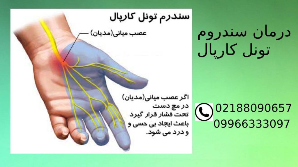 راهکارهای درمان سندروم تونل کارپال
