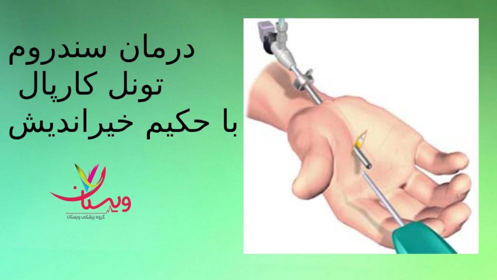 روش درمان حکیم خیراندیش توصیه خیراندیش برای درمان تونل کارپال