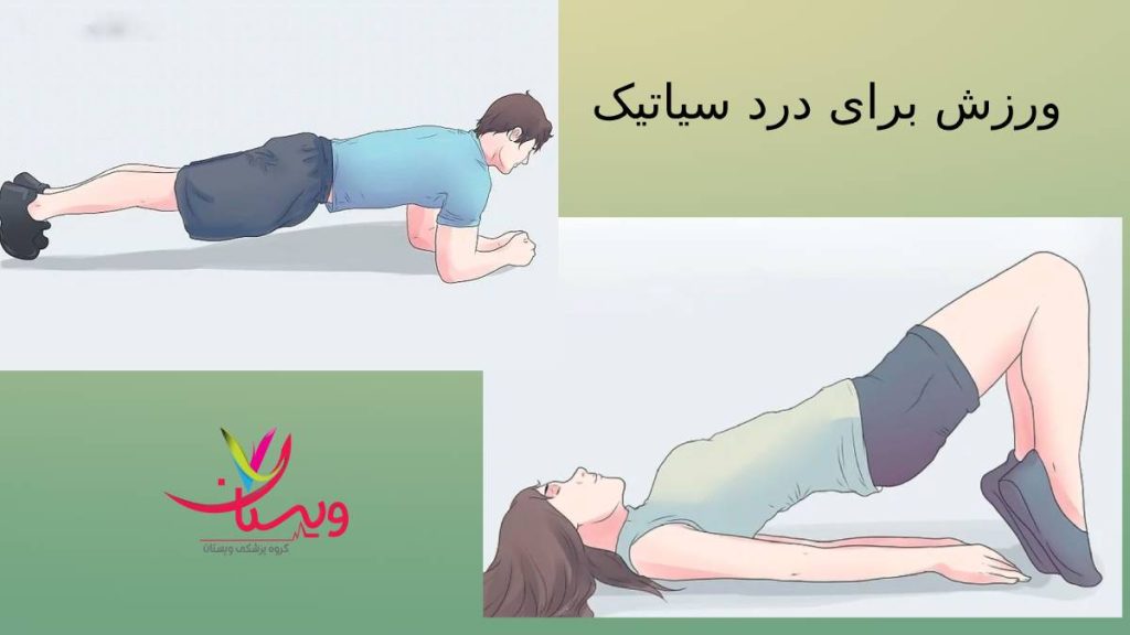 نقش ورزش در درمان نقش ورزش کردن در بهبود گرفتگی سیاتیک