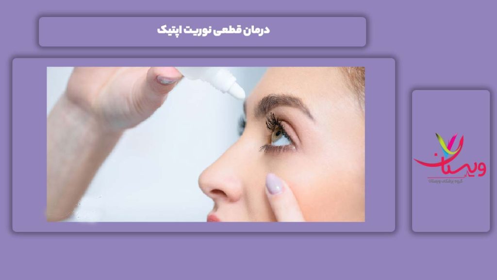 درمان نوریت اپتیک درمان قطعی نوریت اپتیک