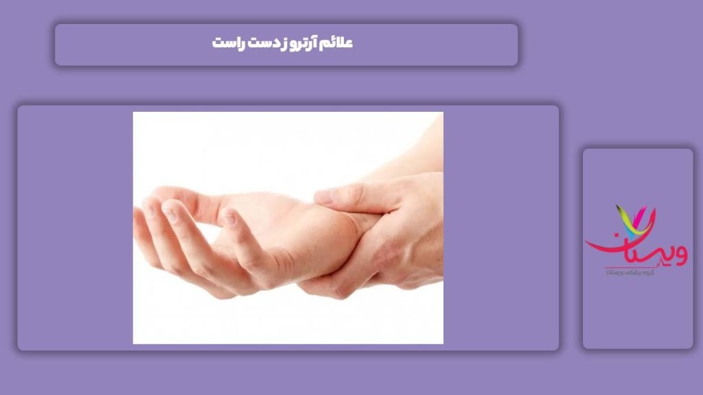 نشانه آرتروز دست راست علائم آرتروز دست راست
