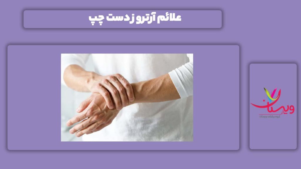 نشانه آرتروز دست چپ نشانه آرتروز دست چپ