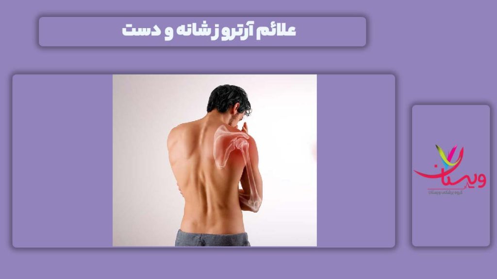 نشانه آرتروز شانه و دست علامت آرتروز شانه و دست