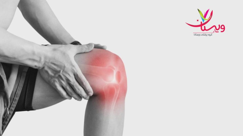 نشانههای پارگی مینیسک علائم پارگی مینیسک زانو چیست؟