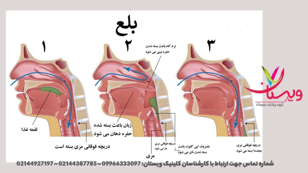 مشکلات بلع و نشانههای آن مشکلات بلع علائم آن