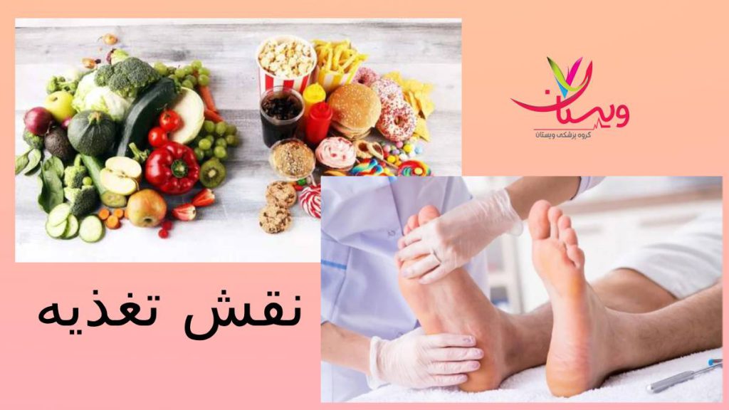 رژیم غدایی برای درمان سندروم تغذیه و درمان پای بیقرار دکتر خیراندیش