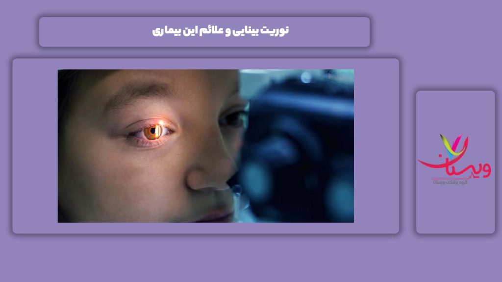 نوریت بینایی