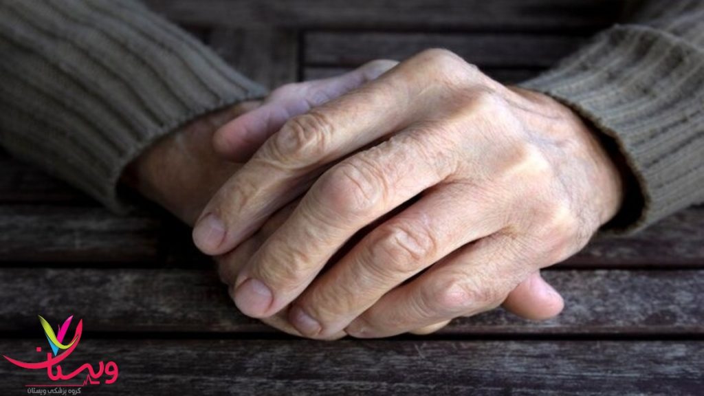 ارتباط بین وضعیت روحی و اختلالات حرکتی در پارکینسون دو دست رویهم قرار گرفته فردی که بیماری پارکینسون دارد