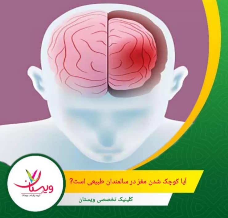 برنامههای جامع شامل تمرینات ذهنی، مدیتیشن، رژیم غذایی مدیترانهای و بازخورد عصبی میتوانند باعث افزایش حجم هیپوکامپ در سالمندان شوند. آیا کوچک شدن مغز در سالمندان طبیعی است؟