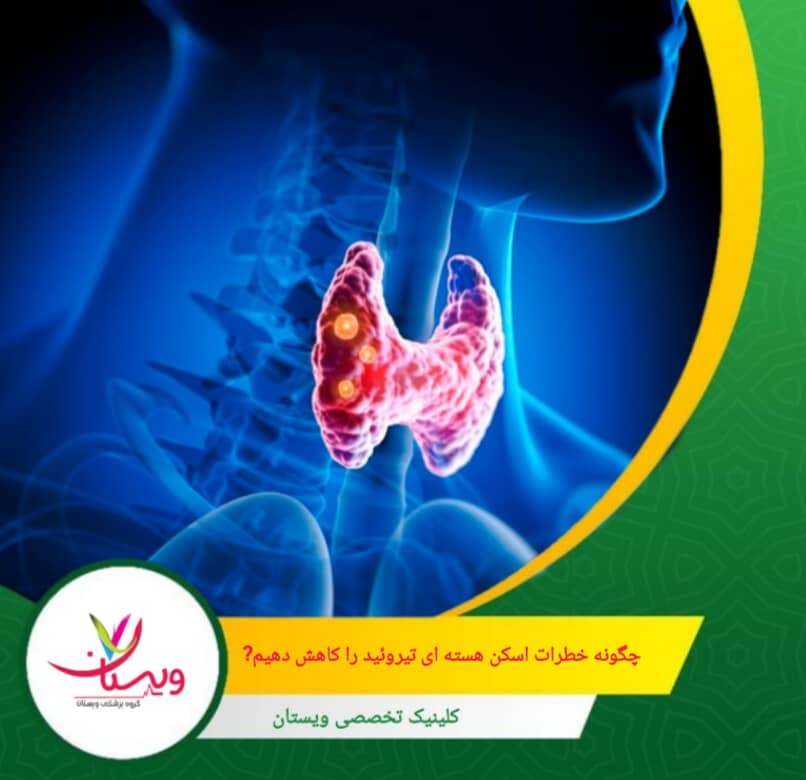 ادامه نوشیدن آب برای 24 تا 48 ساعت پس از اسکن جهت دفع سریعتر مواد رادیواکتیو چگونه خطرات این اسکن را کاهش دهیم؟
