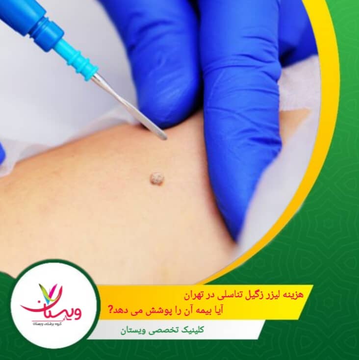 هزینه لیزر زگیل تناسلی در تهران| آیا بیمه آن را پوشش می دهد؟