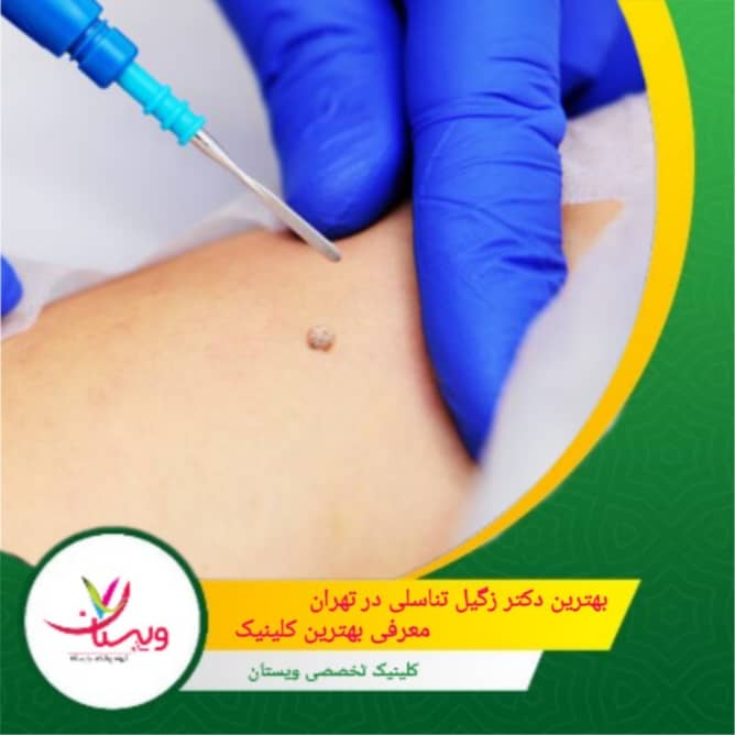 بهترین دکتر زگیل تناسلی در تهران| معرفی بهترین کلینیک