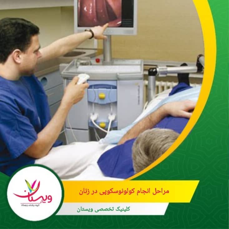 پزشک با وارد کردن لوله کولونوسکوپ از مقعد، به آرامی آن را به داخل روده بزرگ هدایت میکند. مراحل انجام کولونوسکوپی در زنان