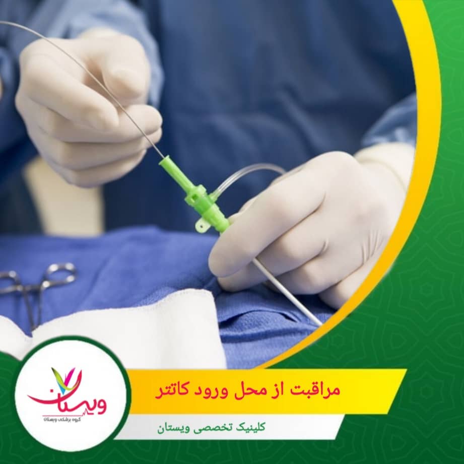 مراقب علائمی مانند قرمزی، ترشح، تورم یا افزایش گرما باشید. اینها میتوانند نشانه عفونت باشند. مراقبت از محل ورود کاتتر: چگونه از زخم محافظت کنیم؟