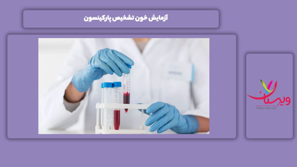 آزمایش خون تشخیص این بیماری آزمایش خون برای تشخیص پارکینسون