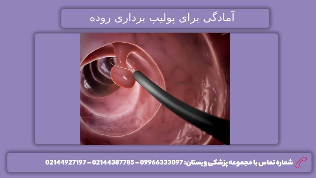 آمادگی قبل از انجام پولیپ آمادگیهای لازم برای تخلیه پولیپ روده