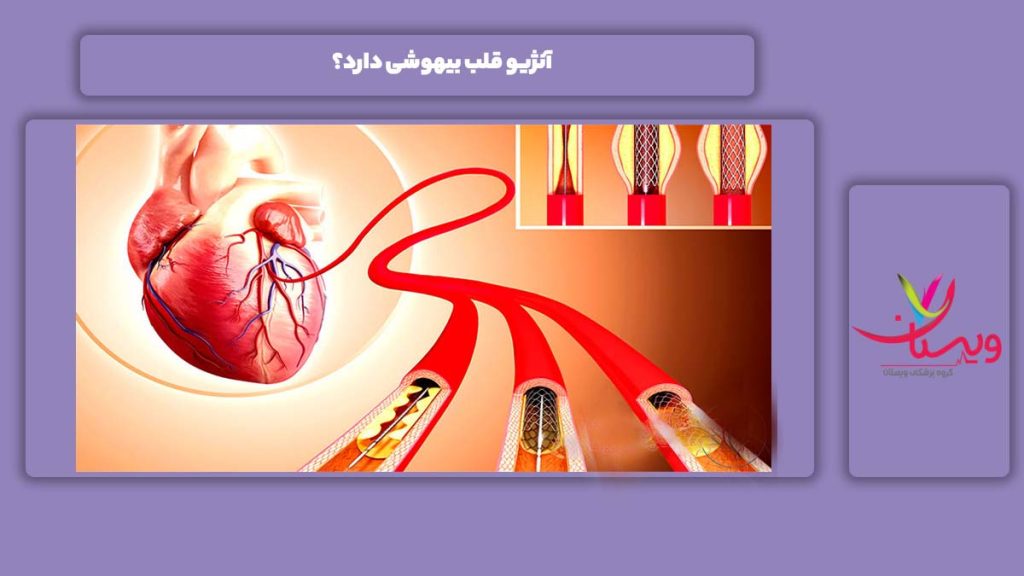 آنژیو قلب بیهوشی ندارد. آنژیو قلب بیهوشی دارد؟