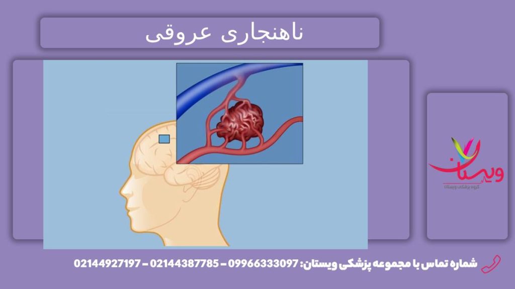 بررسی بیماری ناهنجاری عروقی