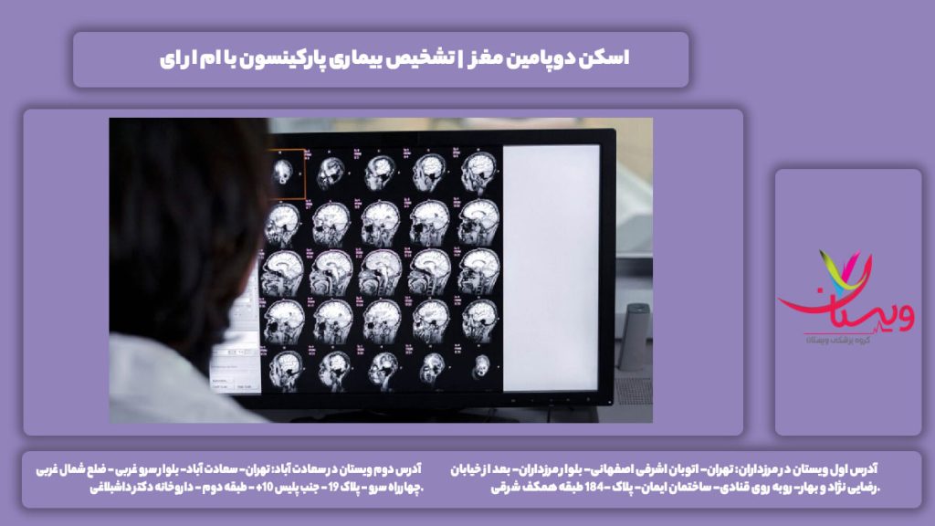 اسکن دوپامین مغز