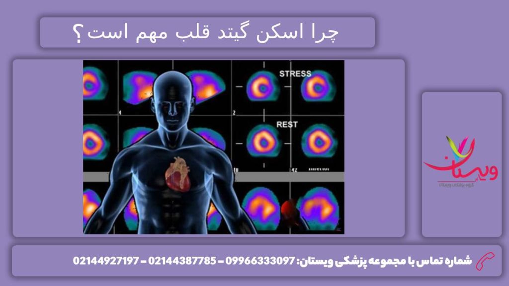 مهم بودن اسکن قلب گیتد چرایی اهمیت اسکن قلب گیتد