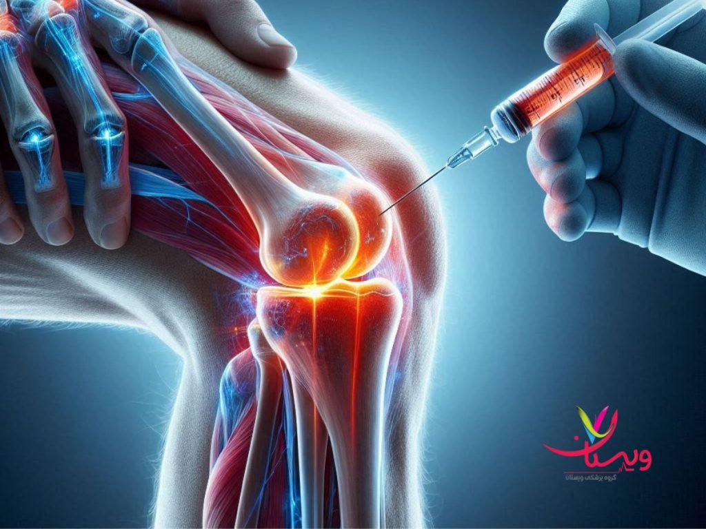 prp تزریق پی آر پی