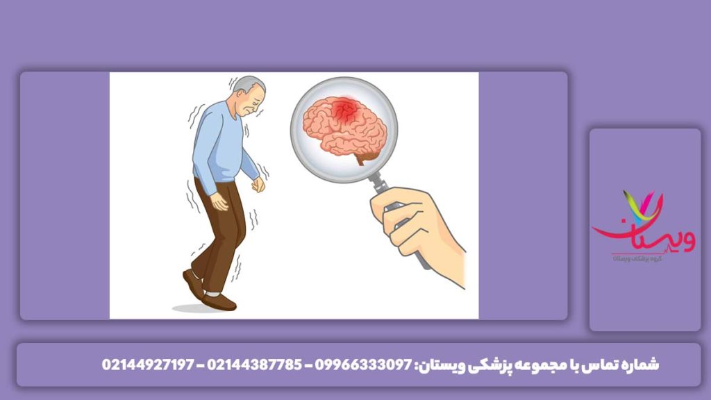 پارکینسون با کمک نوار مغز تشخیص پارکینسون با نوار مغز