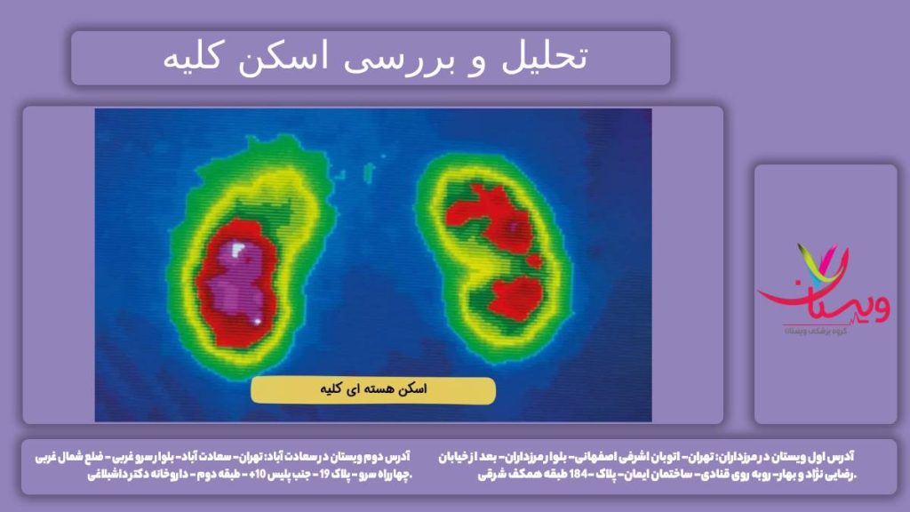 تفسیر اسکن کردن بررسی تفسیر جواب اسکن کلیه