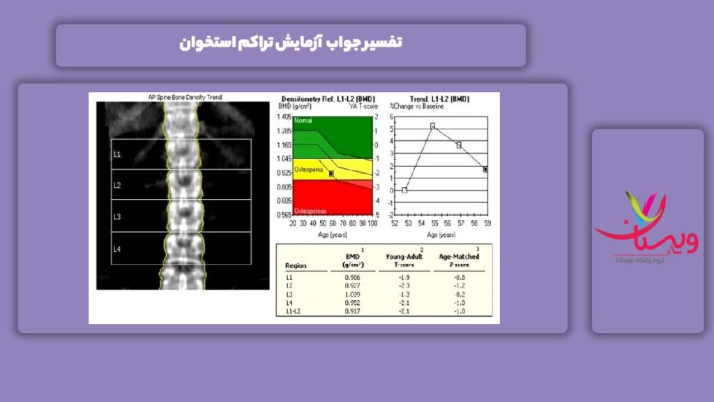 تفسیر جواب آزمایش تراکم استخوان جواب آزمایش تراکم استخوان