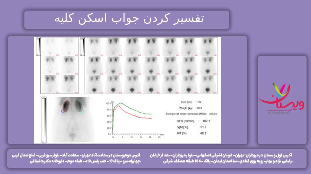 تفسیر جواب اسکن کلیه