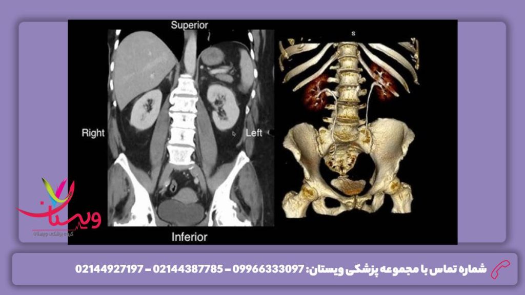 عکس سی تی اسکن بیان تفسیر عکس سی تی اسکن