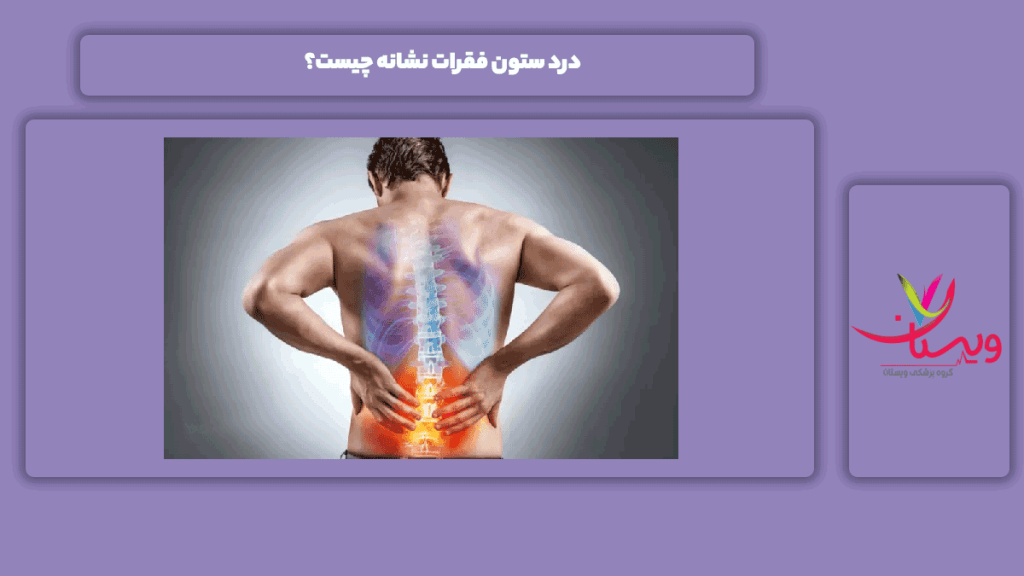 علامت درد در ستون فقرات نشانه درد ستون فقرات