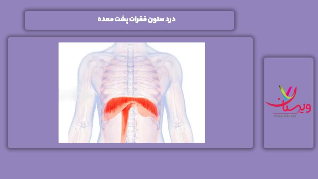 دردهای ستون فقرات پشت معده درد ستون فقرات پشت معده