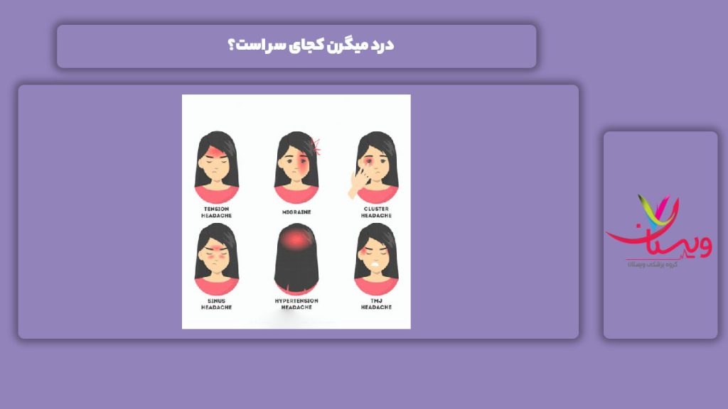 شروع بیماری میگرن در کدام طرف سرع است؟ درد میگرن کجای سر میباشد؟