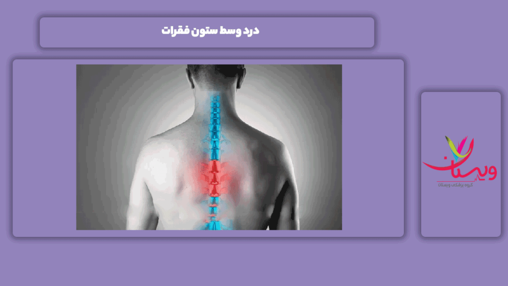 علائم درد وسط ستون فقرات نشانه درد وسط ستون فقرات