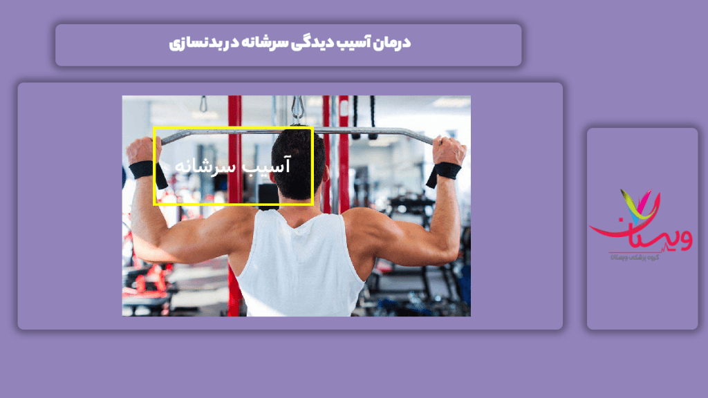 مداوای آسیب سرشانه در بدنسازی علاج سرشانه در رشته بدنسازی