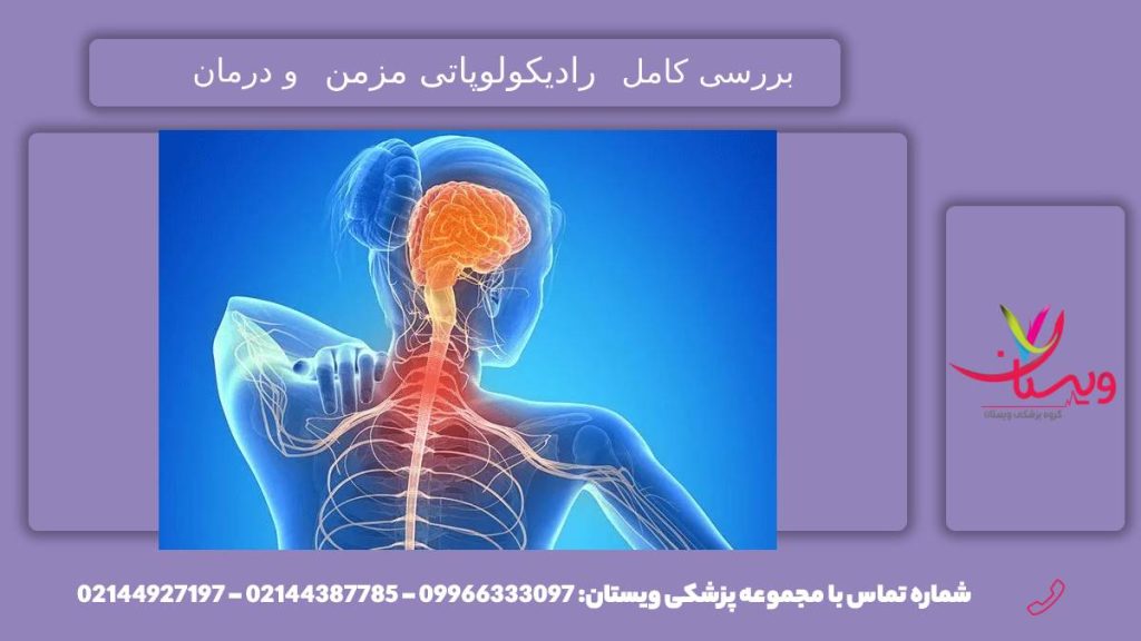 اختلال رادیکولوپاتی چیست؟